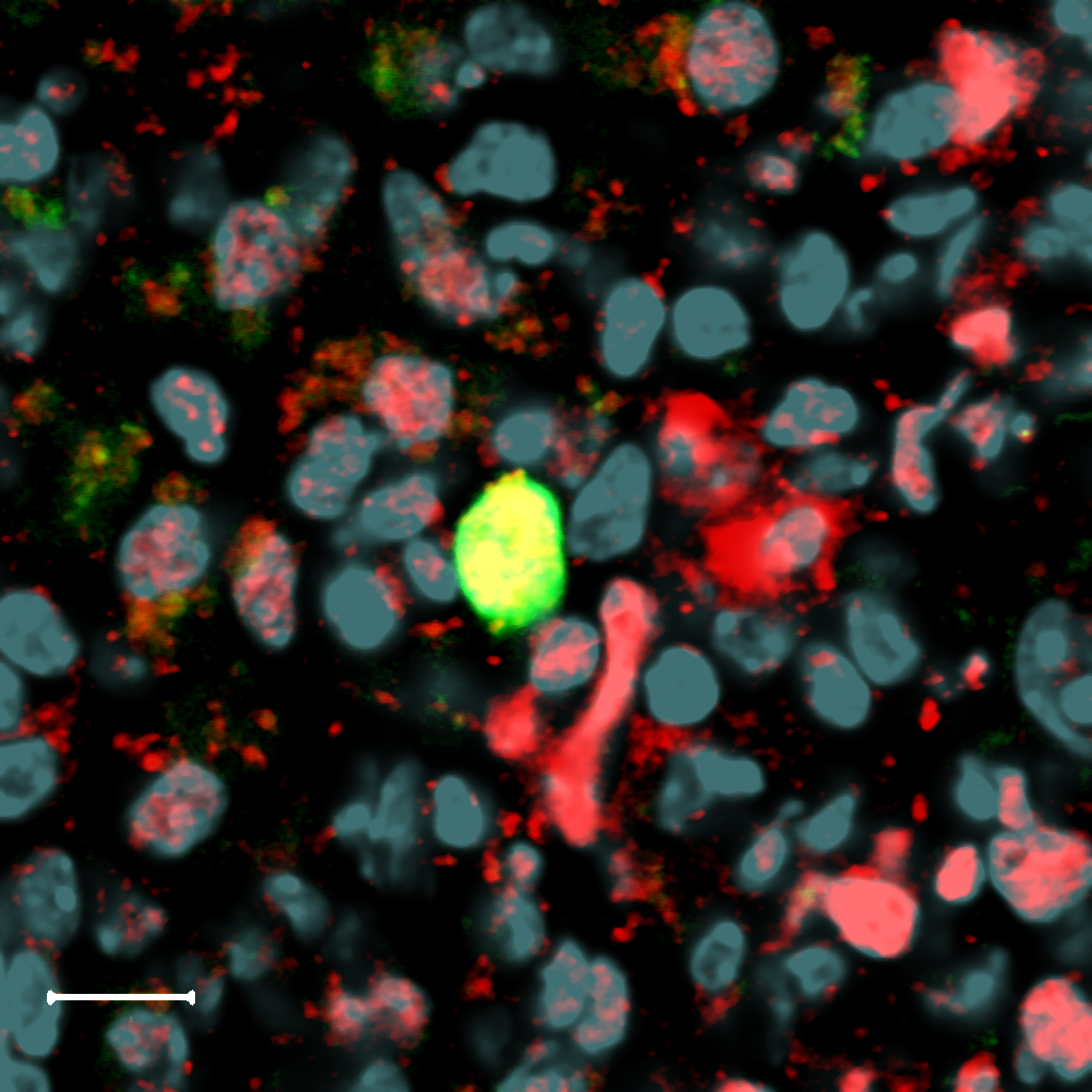 Hematopoietic Stem Cell in its environement
